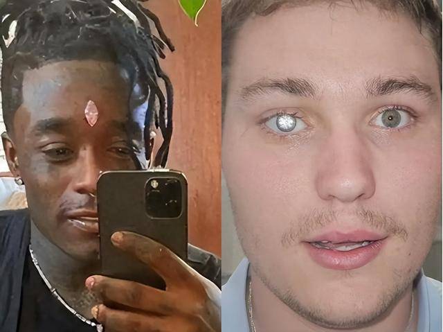 商斥资1450万网友：这是真的眼里有光CQ9电子眼球嵌2克拉钻石！23岁富(图2)